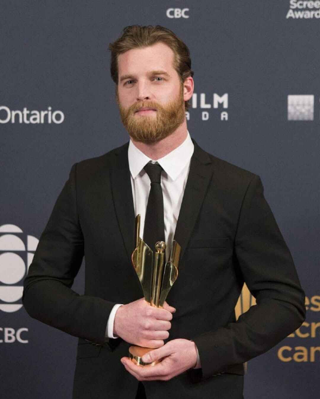 Jared Keeso’s Career Evolution: From Small Roles to TV Icon