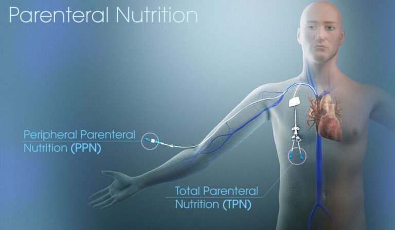 How TPN Works: Delivering Nutrition When the Gut Can’t