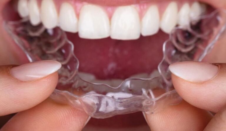 Invisible Solutions for Straighter Teeth