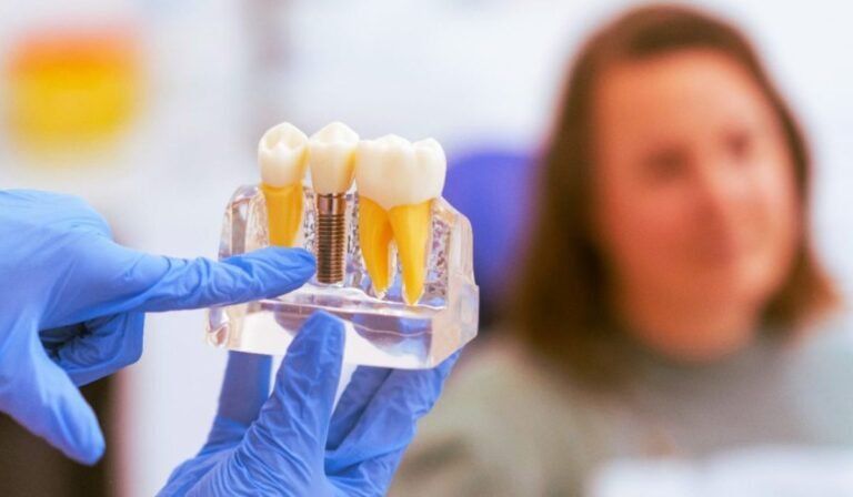 Dental Implant Costs Explained: What You Need to Know